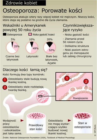 Osteoporoza groźna po pięćdziesiątce