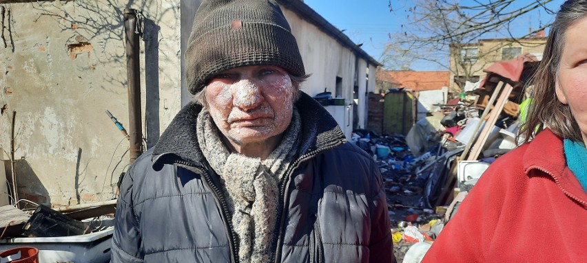 Anita i Bogdan Stępniowie w pożarze domu w Opolu stracili...