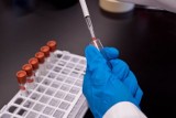Nie wykonano testów na koronawirusa u żadnej z osób zgłaszających się z objawami do szpitala zakaźnego w Gdańsku.
