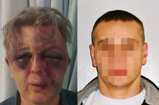 Paul Kohler (z lewej)  przeszedł skomplikowaną operację oka. Za Oskarem P. (po prawej)   brytyjska policja wystawiła list gończy. Nie obowiązuje on  na terenie Polski, dlatego nie pokazujem jego twarz