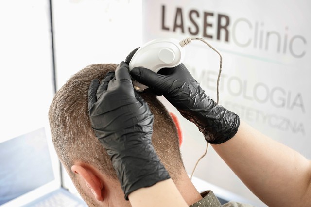 Trychologia, czyli leczenie łysienia i regeneracja włosów jest jednym z najbardziej popularnych zabiegów kosmetologicznych, wykonywanych w Laser Clinic w Kielcach.