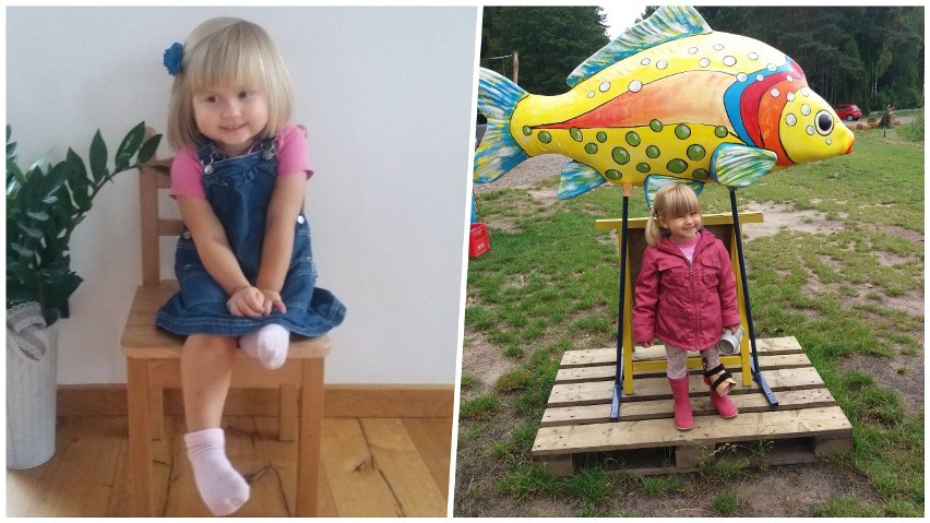 Lewa nóżka, 4-letniej Weroniki  Tyburczy z Lubaczowa, jest...