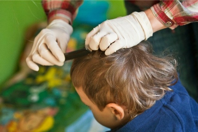 Przestrzeganie zasad higieny głowy i włosów utrudni zagnieżdżanie się pasożytów