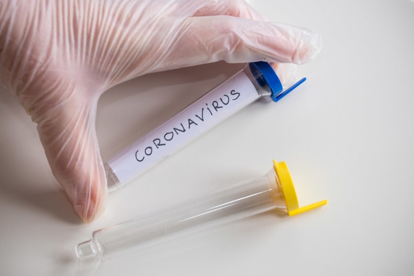 Nowe przypadki koronawirusa