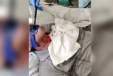 Stracił krtań w wyniku poparzenia kwasem solnym, a po 12 latach odzyskał głos. Innowacyjny zabieg w Szpitalu Śląskim w Cieszynie