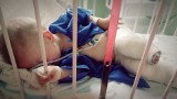 Szpital Degi: Czy zoperowanie skomplikowanej wady kończyn przerosło możliwości poznańskich ortopedów?