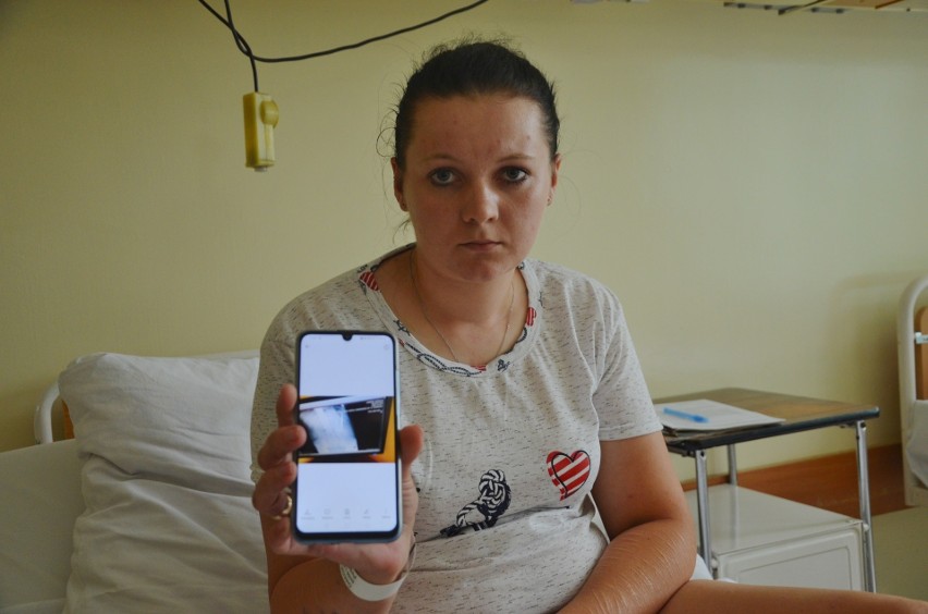 Pacjentka szpitala w Piotrkowie przez dwa lata nosiła w brzuchu kleszcze chirurgiczne. Narzędzie zaszyto jej podczas operacji