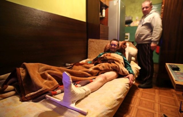 Elżbieta Kisiela ma złamaną lewą nogę. Na operację musi jednak czekać do stycznia