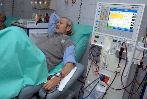 Krzysztof Lichszteld stara się nie myśleć o problemach, jakie mają teraz stacje dializ. W Zachodniopomorskiem jest około 570 pacjentów, którzy stale poddają się dializoterapii.
