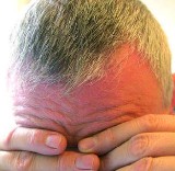 Siwienie włosów może być spowodowane przez wodę utlenioną