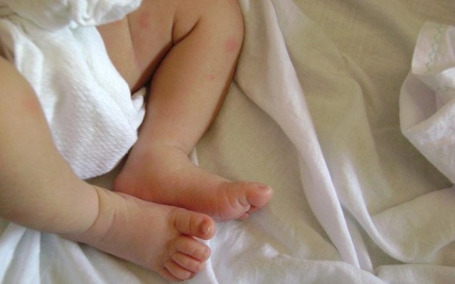 Według kobiety dziecko żyło po urodzeniu. Pełnomocnik twierdzi, że urodziło się martwe.