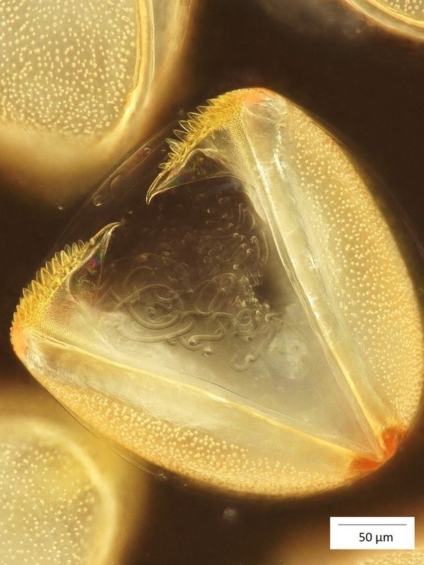 Glochidium - pasożytnicza larwa szczeżui chińskiej...