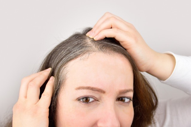 Zaburzenie równowagi w organizmie ma wpływ na wygląd skóry, paznokci i włosów. Suche i wypadające włosy mogą oznaczać niedobór składników, a nawet poważne choroby. Sprawdź, jakie choroby widać na włosach.