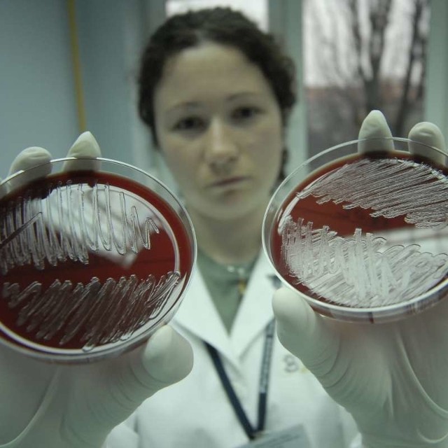 Katarzyna Citowicz, mikrobiolog wojewódzkiego sanepidu, przeprowadza testy na obecność bakterii meningokoków.