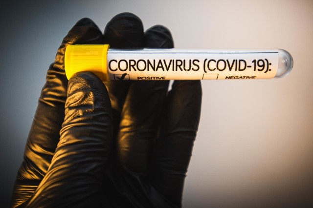 Koronawirus Opolskie. 1416 nowych przypadków COVID-19 w regionie, 56 051 w Polsce [RAPORT 2.02.2022]