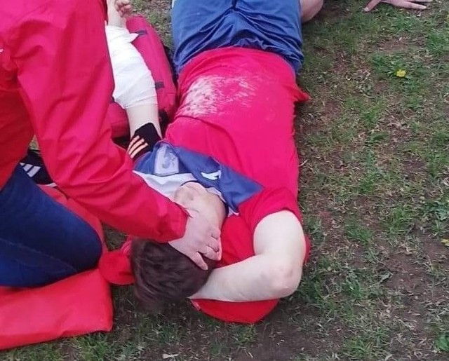 15-letni piłkarz Spartakusa Daleszyce w czasie meczu w Bodzentynie doznał poważnego złamania ręki. W nocy był operowany.