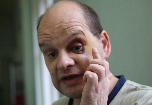 Jerzego Grzegorowskiego czeka operacja oka. Ma nadzieję, że nie straci ponownie wzroku. 