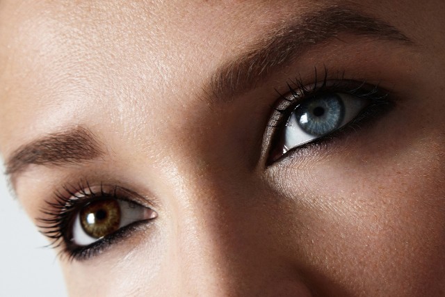 Heterochromia polega na innym rozłożeniu barwnika na minimum dwóch częściach tęczówki jednego oka lub na różnym zabarwieniu obu oczu.