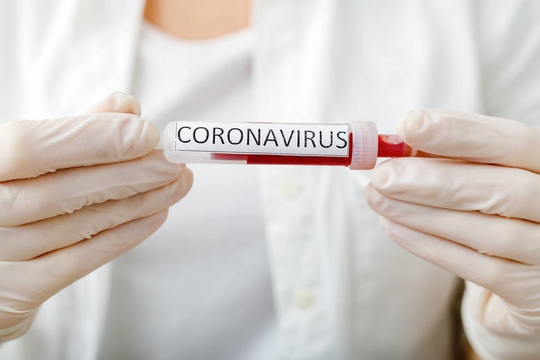 32 nowe przypadki koronawirusa na Śląsku. Zmarła 83-letnia kobieta hospitalizowana w szpitalu w Tychach
