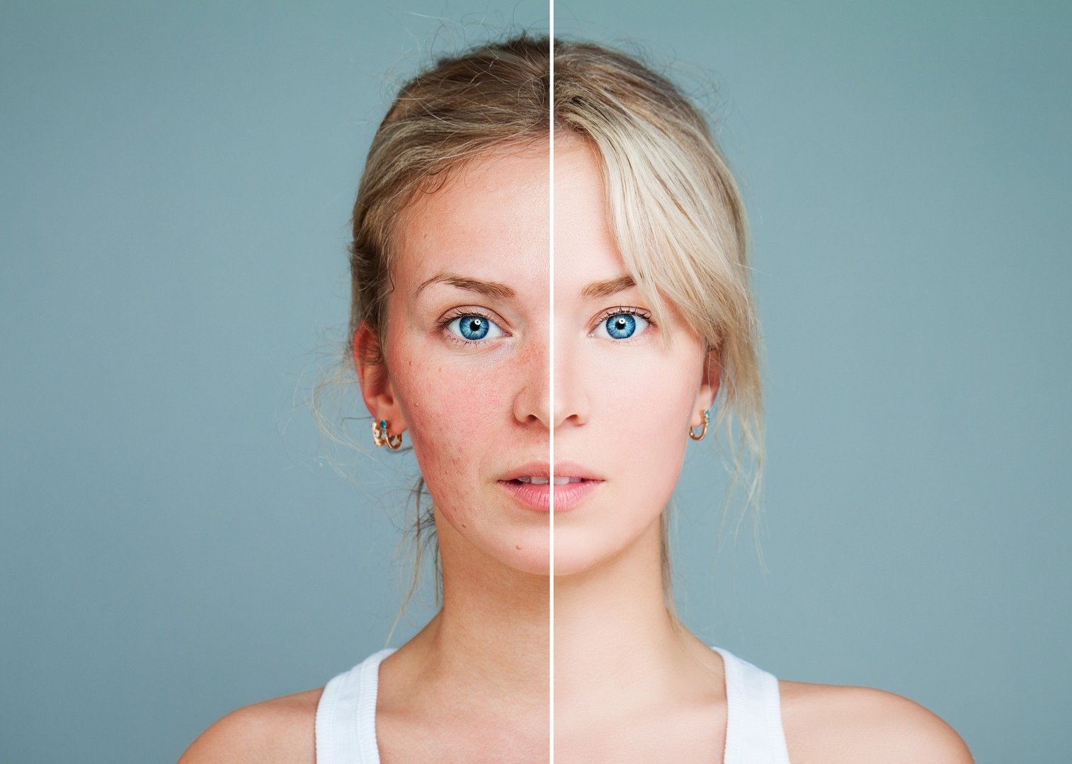 Zaczerwienienia na twarzy – o czym świadczy pieczenie i zaczerwienienie  skóry, nagły rumieniec lub plamy na twarzy? | Strona Zdrowia