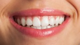 Trzeci komplet zębów? Przełomowy lek japońskich naukowców. „To marzenie każdego dentysty”