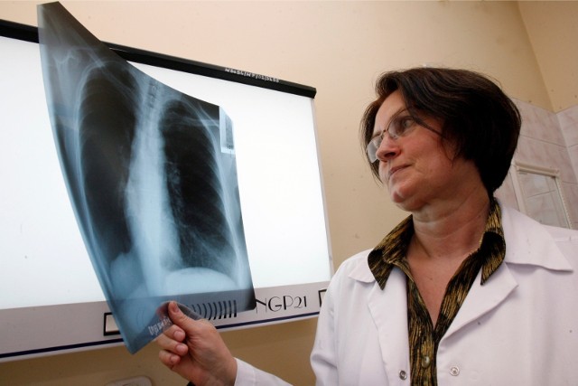 Podstawową metodą, ułatwiającą diagnozowanie gruźlicy, jest prześwietlenie klatki piersiowej