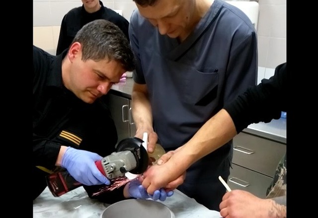 Żeby uwolnić palec pacjenta, strażak Marek Kott musiał przeciąć "obrączkę" z dwóch stron.