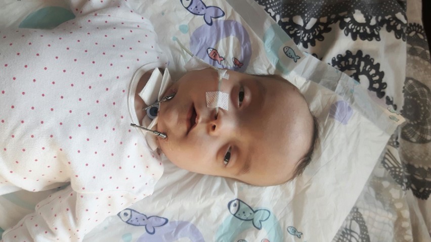 10-miesięczna Karolinka Gazda ze Stalowej Woli potrzebuje pomocy. Dziewczynka urodziła się z bardzo rzadkim zespołem genetycznym