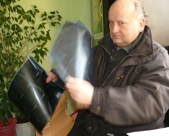 Zbigniew Jasiński pokazuje zdjęcia rentgenowskie, na których jego zdaniem jest czarno na białym jego choroba.