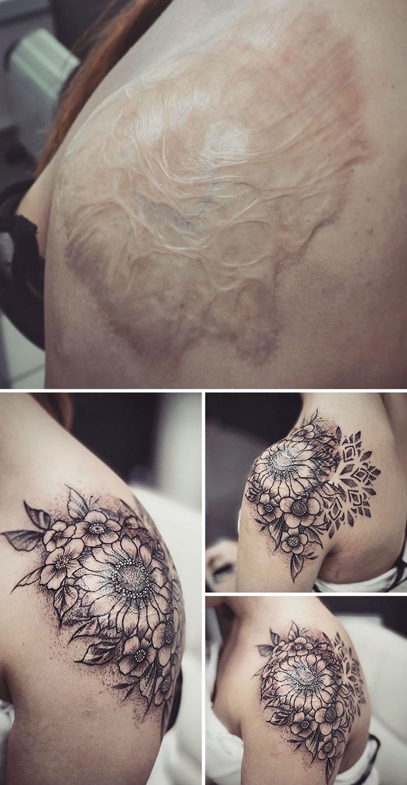 Kreatywne tatuaże na bliznach