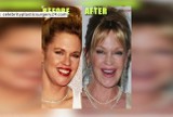 Czy Melanie Griffith przesadziła z operacjami plastycznymi? [WIDEO]