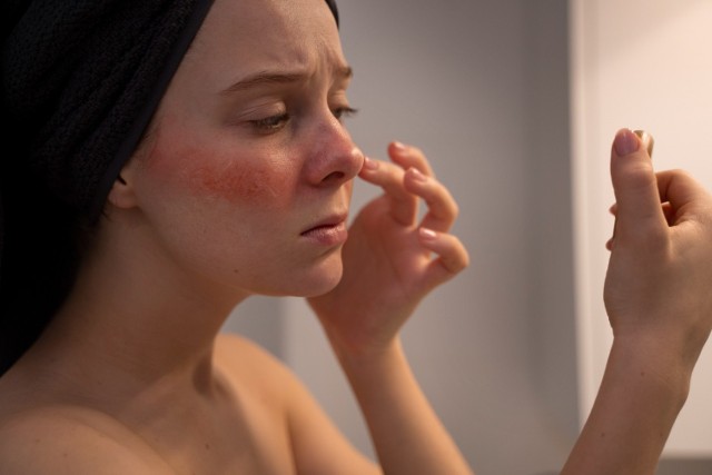 Zaczerwienienia na twarzy, którym towarzyszą zmiany skórne, to nie zawsze dający skorygować się problem kosmetyczny. Zmiany mogą świadczyć o poważniejszej chorobie.