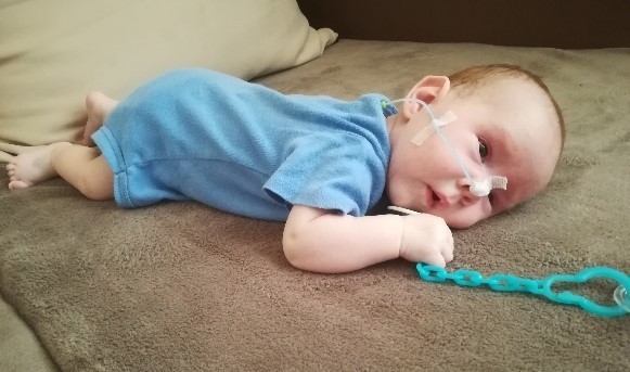 Dwuletni Szymonek Sternik z Ćmielowa walczy o życie! Potrzeba pieniędzy na jego operację. Pomóżmy! [ZDJĘCIA]