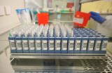 The Times: Obiecujące testy nad lekiem, który może pomagać w leczeniu koronawirusa. Mniej pacjentów potrzebuje respiratorów