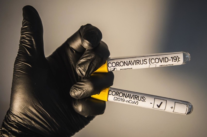 W poniedziałek potwierdzono 70 nowych zakażeń koronawirusem w regionie. Połowa w DPS Jędrzejów