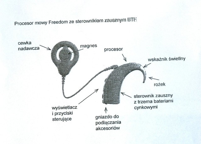 Tak wygląda procesor mowy. Urządzenie należące do chłopca było w zielonym etui.