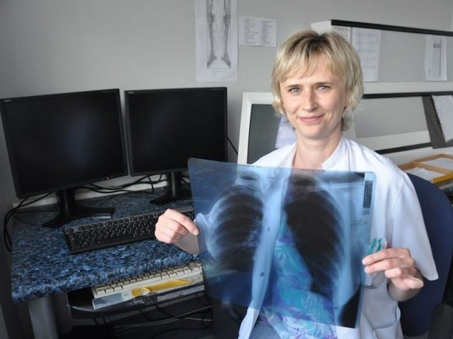 Wystarczy jedno kliknięcie i lekarz będzie miał obraz w komputerze. Nie będzie już musiał czekać, aż wywołamy zdjęcie &#8211; mówi Beata Kotowska, technik RTG.