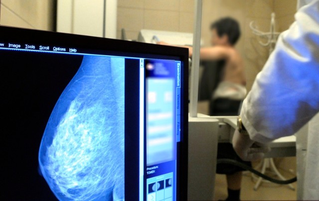 Rak piersi to jeden z czołowych zabójców kobiet w Polsce. W początkowym okresie nie daje on żadnych objawów.