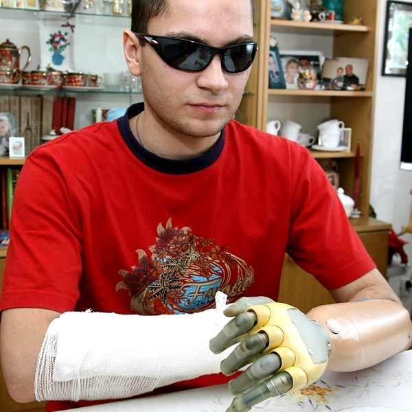 Marcin ma najnowocześniejszą na świecie bioniczną protezę dłoni. Dzięki sztucznej ręce bez problemu podnosi nawet ciężkie przedmioty.
