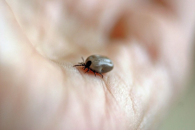 Coraz więcej kleszczy pojawia się w lasach. Wygłodniałe polują na żywiciela: najczęściej człowieka lub psa. Kleszczy nie można lekceważyć, bowiem mogą przenosić groźne choroby! Zobacz, jak ochronić przed nimi siebie i swoich najbliższych.Sposoby na ochronę przed kleszczami znajdziesz na następnych stronach. Wystarczy przesunąć zdjęcie gestem lub nacisnąć strzałkę w prawo.