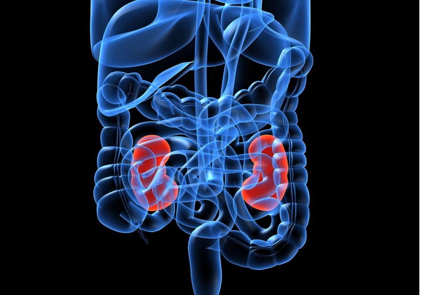 Kamienie Nerkowe Objawy I Rodzaje Czym Są Kamienie Moczowe I Jak Się Ich Pozbyć Tak 5137