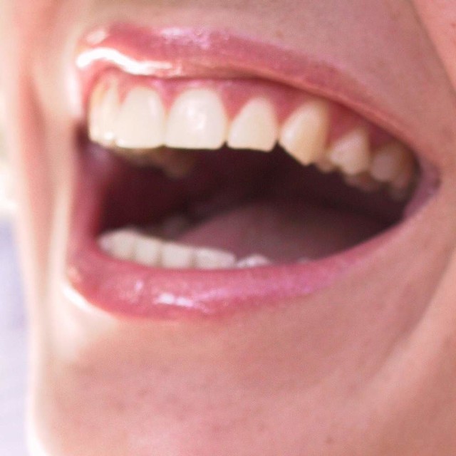 Polacy boją się chodzić do dentysty, aż 57 proc. osób robi to rzadziej niż raz w roku.