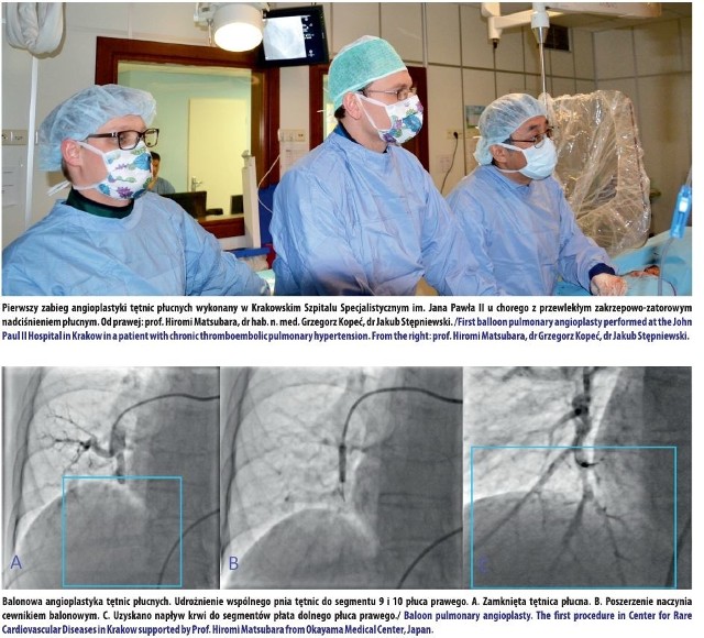 Pierwszy zabieg angioplastyki tętnic płucnych wykonany w Krakowskim Szpitalu Specjalistycznym im. Jana Pawła II. Od lewej: dr Jakub Stępniewski, dr hab. n. med. Grzegorz Kopeć, prof. Hiromi Matsubara