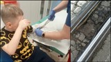 8-letni chłopczyk złamał rękę przez wyrwę w torowisku, czeka go bolesna rehabilitacja. Co na to MPK Wrocław?