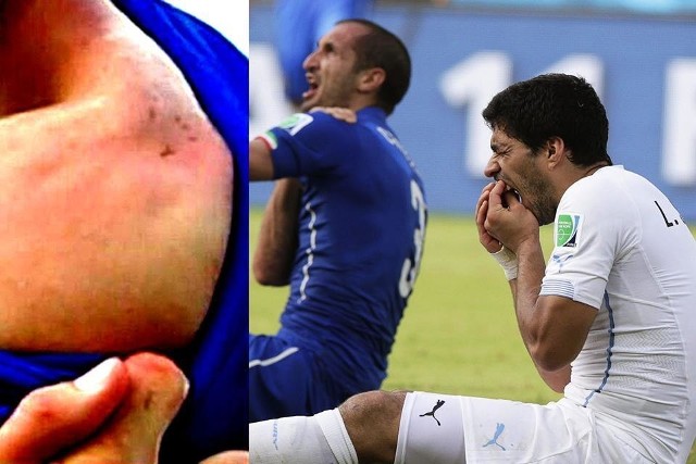 Luis Suarez został ukarany czteromiesięczną dyskwalifikacją