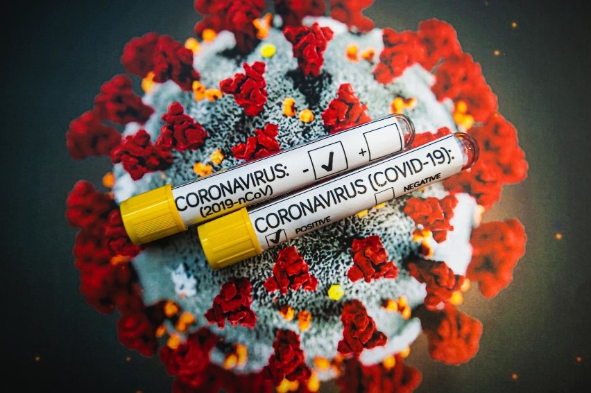 Koronawirus na Pomorzu 8.12.2020 r. 23 osoby zmarły i jest 515 nowych przypadków zakażenia