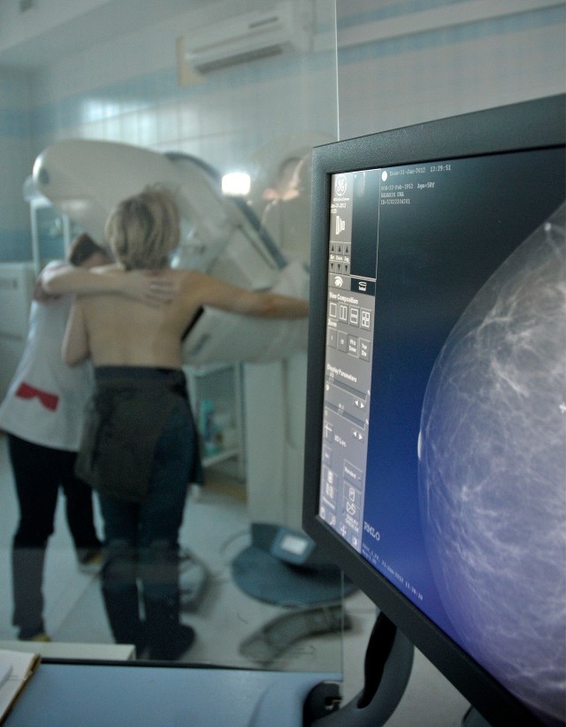 W WCO - po połączeniu - ma być tzw. Breast Cancer Unit, czyli ośrodek wyspecjalizowany w leczeniu raka piersi.