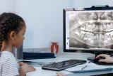 Pierwsza wizyta z dzieckiem u dentysty – kiedy się na nią zdecydować? Przebieg wizyty