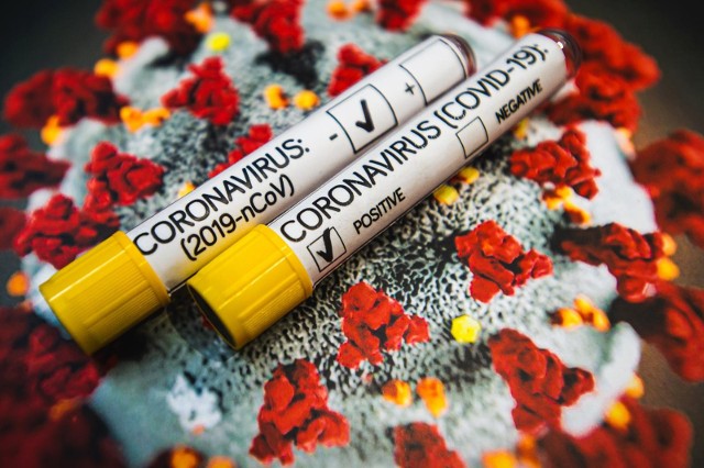 Szczepionka na koronawirusa: Szczepienia na COVID-19 w punktach pobrań drive thru, u lekarzy rodzinnych i farmaceutów? Takie są plany rządu