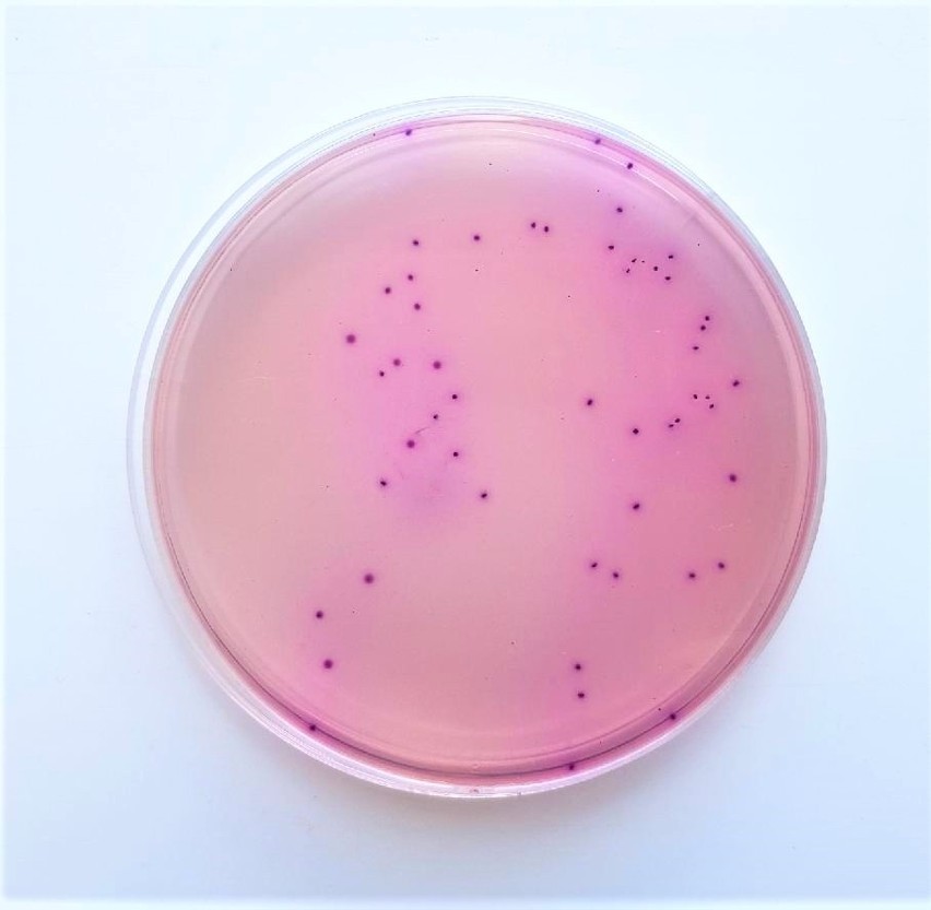 Badania laboratoryjne wykazały pojawienie się bakterii w 10...